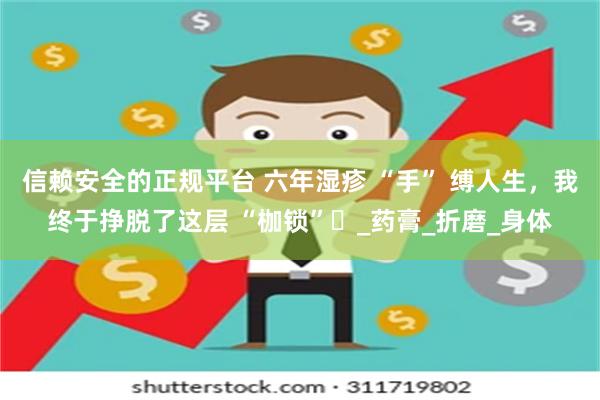 信赖安全的正规平台 六年湿疹 “手” 缚人生,我终于挣脱了这层 “枷锁”_药膏_折磨_身体